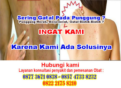 obat gatal di punggung review , obat gatal di punggung dan lengan , obat gatal di punggung alodokter , obat gatal di punggung pria , obat gatal di punggung parah , obat gatal di punggung saat hamil , obat gatal di punggung pada wanita , obat gatal di punggung dan dada , obat gatal di punggung obat , obat gatal di punggung hiv , obat gatal di punggung , obat gatal di punggung gatal , obat gatal di punggung adalah , obat obat gatal di punggung alami , obat obat gatal di punggung ampuh , obat gatal di di punggung apa obatnya , obat obat gatal di punggung apotik , obat menghilangkan gatal di punggung alami , obat gatal di di punggung apakah berbahaya , obat obat gatal di punggung paling ampuh , obat gatal di di punggung pertanda apa , obat gatal di punggung badan , obat gatal di punggung bekas , obat gatal di batu punggung , obat gatal di di punggung banyak , obat gatal di di punggung bayi , obat gatal di di punggung belakang , obat gatal di di punggung badan , obat gatal di pada punggung bayi , obat gatal di di bagian punggung , obat obat gatal di buat punggung , obat gatal di punggung caladine , obat gatal di punggung cara menghilangkan , obat obat gatal di punggung caladine , obat menghilangkan gatal di punggung cepat , obat gatal di punggung dan cara mengatasinya , obat gatal di punggung dan cara menghilangkannya , obat menghilangkan gatal di punggung dengan cepat , obat penyebab gatal di punggung dan cara mengatasinya , obat cream gatal di punggung , obat ciri gatal di punggung , obat gatal di punggung dr kun , obat gatal di punggung disebabkan oleh , obat gatal di punggung dettol , obat gatal di punggung dan penyebabnya , obat gatal di di punggung manjur, obat gatal di di punggung saat hamil manjur, obat gatal di di punggung dan dada manjur, obat gatal di di punggung penyebab manjur, obat gatal di di punggung pria manjur, obat gatal di di punggung dan lengan manjur, obat gatal di di punggung hiv manjur, obat gatal di di punggung gatal manjur, obat gatal di di punggung disebabkan oleh manjur, obat gatal di punggung erha manjur, obat obat gatal di punggung erha manjur, obat bekas gatal di punggung erha manjur, obat gatal di di punggung erha manjur, obat harga obat gatal di punggung erha manjur, obat perawatan gatal di punggung di erha manjur, obat efek gatal di punggung manjur, obat gatal di punggung female daily manjur, obat gatal di punggung female daily forum manjur, obat bekas gatal di punggung female daily manjur, obat obat gatal di punggung female daily manjur, obat cara mengatasi gatal di punggung female daily manjur, obat facial gatal di punggung manjur, obat menghilangkan gatal di di punggung female daily manjur, obat foto gatal di punggung manjur, obat faktor gatal di punggung manjur, obat gatal di di punggung gejala penyakit apa manjur, obat gambar gatal di punggung manjur, obat gejala gatal di punggung manjur, obat gel gatal di punggung manjur, obat gatal di di punggung terasa gatal manjur, obat gatal di punggung hitam manjur, obat gatal di punggung hilang manjur, obat gatal di punggung hamil manjur, obat gatal di punggung herocyn manjur, obat gatal di punggung ibu hamil manjur, obat obat gatal di punggung herbal manjur, obat hilangkan gatal di punggung manjur, obat gatal di punggung ihhhh manjur, obat gatal di punggung pada ibu hamil manjur, obat gatal di punggung jelas menjengkelkan inilah penyebab dan cara mengatasinya manjur, obat gatal di punggung jf sulfur manjur, obat jenis gatal di punggung manjur, obat jamu gatal di punggung manjur, obat gatal di punggung kaskus manjur, obat punggung gatal dian kenapa manjur, obat gatal di di punggung kaskus manjur, obat obat gatal di punggung kaskus manjur, obat gatal di di punggung karena ampuh, obat menghilangkan gatal di punggung kaskus ampuh, obat gatal di di punggung karena apa ampuh, obat gatal di di punggung kenapa ya ampuh, obat gatal di sampai ke punggung ampuh, obat lulur gatal di punggung ampuh, obat laser gatal di punggung ampuh, obat lotion gatal di punggung ampuh, obat perawatan gatal di punggung di lbc ampuh, obat gatal di di punggung dan leher ampuh, obat perawatan gatal di punggung di larissa ampuh, obat lifebuoy gatal di punggung ampuh, obat lbc gatal di punggung ampuh, obat gatal di punggung menahun ampuh, obat gatal di punggung menghilangkan ampuh, obat gatal di punggung menular ampuh, obat gatal di punggung membandel ampuh, obat gatal di di punggung menandakan ampuh, obat gatal di di punggung muka ampuh, obat gatal di di punggung menular ampuh, obat gatal di di punggung meradang ampuh, obat apakah gatal di punggung menular ampuh, obat gatal di punggung natasha ampuh, obat perawatan gatal di punggung di natasha ampuh, obat ngilangin gatal di punggung ampuh, obat punggung naik gatal di ampuh, obat gatal di punggung obatnya apa ampuh, obat gatal di di punggung obatnya apa ampuh, obat gatal di di punggung obatnya ampuh, obat obat gatal di punggung di apotik ampuh, obat gatal di punggung penyebab ampuh, obat gatal di punggung pada bayi ampuh, obat gatal di pada punggung ampuh, obat gatal di pada punggung dan dada ampuh, obat gatal di di punggung review ampuh, obat bekas gatal di punggung review ampuh, obat sabun gatal di punggung review ampuh, obat ramuan gatal di punggung ampuh, obat gatal di punggung sakit ampuh, obat gatal di punggung sabun ampuh, obat punggung gatal dian saat hamil ampuh, obat menghilangkan gatal di punggung secara alami ampuh, obat mengobati gatal di punggung secara alami ampuh, obat gatal di di punggung sakit ampuh, obat gatal di punggung tidak sembuh ampuh, obat cara menghilangkan gatal di punggung secara cepat ampuh, obat gatal di di punggung tidak bisa hilang ampuh, obat obat gatal di punggung tradisional bagus, obat gatal di di punggung tanda hiv bagus, obat gatal di punggung putih telur bagus, obat gatal di di punggung tanda penyakit bagus, obat gatal di di punggung tanda bagus, obat obat gatal di di punggung tradisional bagus, obat treatment gatal di punggung bagus, obat terapi gatal di punggung bagus, obat obat gatal di untuk punggung bagus, obat sabun gatal di untuk punggung bagus, obat gatal di punggung vitacid bagus, obat gatal di di punggung wanita bagus, obat penyebab gatal di di punggung wanita bagus, obat gatal di di punggung pada wanita bagus, obat obat gatal di punggung yang ampuh bagus, obat menghilangkan gatal di punggung yang membandel bagus, obat obat gatal di punggung yang paling ampuh bagus, obat obat gatal di punggung yang dijual di apotik bagus, obat obat gatal di di punggung yang alami bagus, obat cara menghilangkan gatal di punggung yang membandel bagus, obat gatal di punggung review bagus, obat gatal di punggung dan lengan bagus, obat gatal di punggung alodokter bagus, obat gatal di punggung pria bagus, obat gatal di punggung parah bagus, obat gatal di punggung saat hamil bagus, obat gatal di punggung pada wanita bagus, obat gatal di punggung dan dada bagus, obat gatal di punggung obat bagus, obat gatal di punggung hiv bagus, obat gatal di punggung bagus, obat gatal di punggung gatal bagus, obat gatal di punggung adalah bagus, obat obat gatal di punggung alami bagus, obat obat gatal di punggung ampuh bagus, obat gatal di di punggung apa obatnya bagus, obat obat gatal di punggung apotik bagus, obat menghilangkan gatal di punggung alami bagus, obat gatal di di punggung apakah berbahaya bagus, obat obat gatal di punggung paling ampuh bagus, obat gatal di di punggung pertanda apa bagus, obat gatal di punggung badan bagus, obat gatal di punggung bekas bagus, obat gatal di batu punggung bagus, obat gatal di di punggung banyak bagus, obat gatal di di punggung bayi bagus, obat gatal di di punggung belakang bagus, obat gatal di di punggung badan alami, obat gatal di pada punggung bayi alami, obat gatal di di bagian punggung alami, obat obat gatal di buat punggung alami, obat gatal di punggung caladine alami, obat gatal di punggung cara menghilangkan alami, obat obat gatal di punggung caladine alami, obat menghilangkan gatal di punggung cepat alami, obat gatal di punggung dan cara mengatasinya alami, obat gatal di punggung dan cara menghilangkannya alami, obat menghilangkan gatal di punggung dengan cepat alami, obat penyebab gatal di punggung dan cara mengatasinya alami, obat cream gatal di punggung alami, obat ciri gatal di punggung alami, obat gatal di punggung dr kun alami, obat gatal di punggung disebabkan oleh alami, obat gatal di punggung dettol alami, obat gatal di punggung dan penyebabnya alami, obat gatal di di punggung alami, obat gatal di di punggung saat hamil alami, obat gatal di di punggung dan dada alami, obat gatal di di punggung penyebab alami, obat gatal di di punggung pria alami, obat gatal di di punggung dan lengan alami, obat gatal di di punggung hiv alami, obat gatal di di punggung gatal alami, obat gatal di di punggung disebabkan oleh alami, obat gatal di punggung erha alami, obat obat gatal di punggung erha alami, obat bekas gatal di punggung erha alami, 