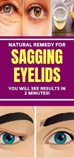Beauty Natural Remedy for Sagging Eyelids – You Will See Results in 2 Minutes!