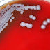 A bactéria encontrada no Mississipi que deixou autoridades dos EUA em alerta