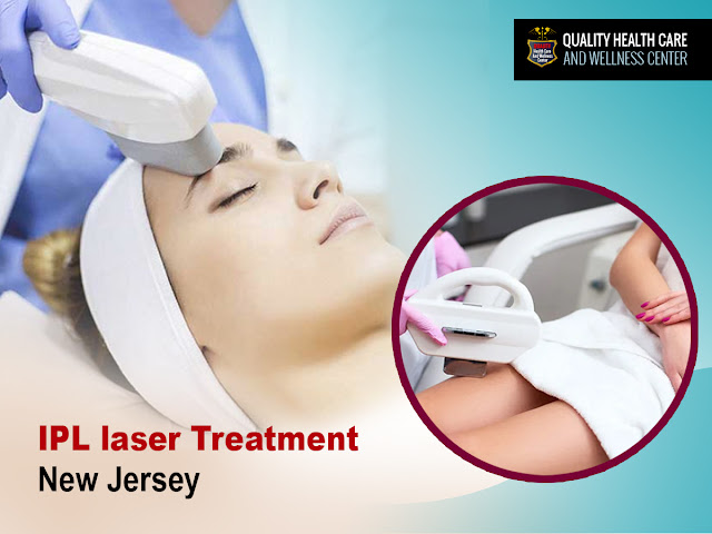 IPL treatment New Jersey