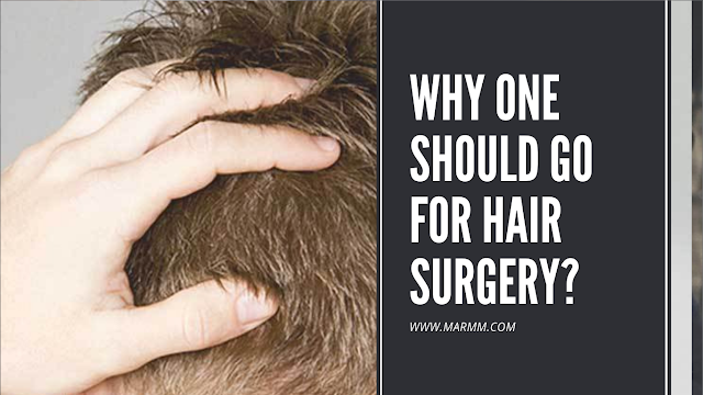 Hair transplant in Indore