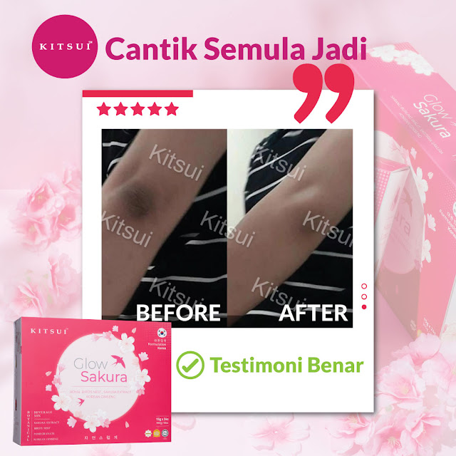 Kitsui Glow Sakura Sarang Burung Walit, Tingkatkan Aura Wajah Secara Semulajadi dengan Formulasi dari Korea, kitsui glow sakura, kitsui glow sakura review, kitsui Malaysia, kejelitaan kulit bermula dari dalaman, kitsui Korean whitie, produk kitsui untuk kurus dan putih, kitsui Korean white side effect, kitsui Korean white review, produk kitsui bahaya, pantang larang kitsui Korean white, kitsui Korean white review Malaysia, kitsui Korean white and tomato review, jdt blogger, kitsui bird nest, kitsui product, kitsui review, kitsui malaysia review, kitsui malaysia testimoni, kitsui watsons Malaysia, kitsui new launch, kitsui glow sakura sarang burung walit, kitsui glow sakura royal bird nest