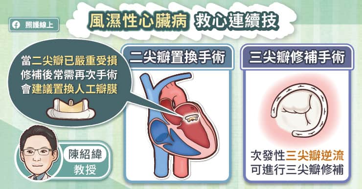 風濕性心臟病 救心連續技