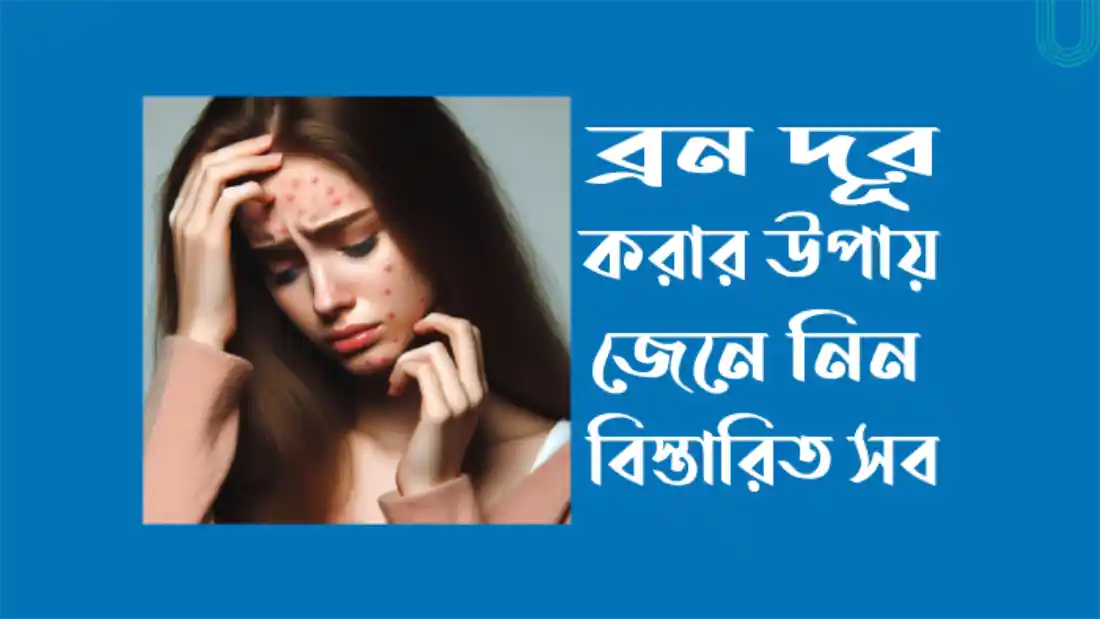 তৈলাক্ত ত্বকের ব্রণ দূর করার উপায়