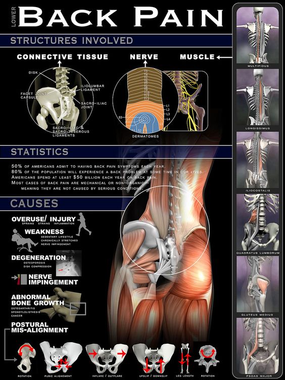 Natural Back Pain Relief Method