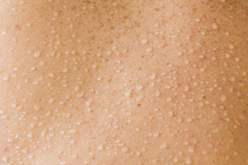 10 Skin Problems That Might Indicate a Serious Disease