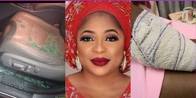 Popular Nollywood actress,  Kemi Afolabi has recounted her horrible experience with armed robbers in January 2022.  The actress took to the Instagram section of her colleague Iyabo Ojo’s Instagram post on Tuesday to recollect how robbers broke her car window while sympathising with Iyabo’s friend who was recently attacked in Lagos.  Relieving her experience, the ailing actress pointed out that the robbers usually come out during traffic to steal from people.  She said: “Eh God o! This is rampant now. Small traffic ehh these guys come out from nowhere to start breaking your car glass to steal. Only God can save us in this country. Pele.”  In an Instagram post on January 5, Kemi narrated how she got injured during a robbery attack on her way back from a movie set.  According to the actress, the armed robbers broke the windscreen of her car which left her injured due to the impact of the shattered glass, she also said her phones and other valuables were taken and her driver took a hit on his head.  Narrating the incident, Kemi wrote: ''I am in a state of shock! Traumatized!! I haven’t closed my eyes to sleep since yesterday. I also experienced the highly poor insecurity state in Nigeria which has become a norm. No matter how much we scream and cry it always falls on deaf ears of those who govern us even when death is involved.  “My driver and I were attacked by armed robbers at Arepo where I went to film while in traffic on our way back home yesterday, They broke my windscreens, left my whole body with wounds and skin in pains because of the impact of the shattered glass which was forcefully broken while I was in the car, my arm was cut with a cutlass, they took my phones, belongings and ran off! Sadly my driver also took a hit to his head.”