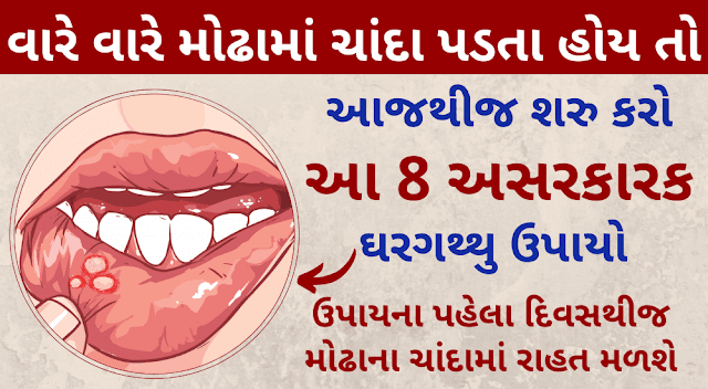 મોઢામાં ચાંદા પાડવાના કારણો અને તેના અસરકારક 8 ઉપાયો | Mouth Ulcers Symptoms, Diagnosis, and Treatments