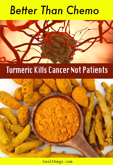 Turmeric Kills Cancer – Not Patients and Better Than Chemo