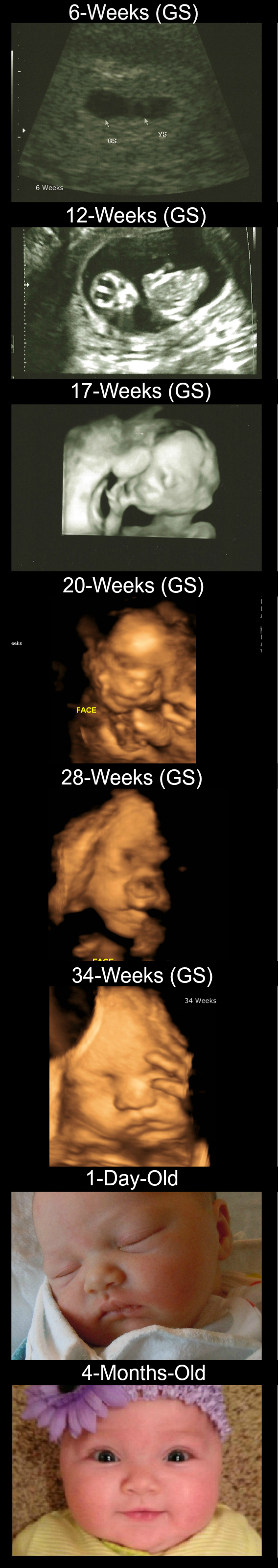 3D Ultrasound Pregnancy to Baby Timeline