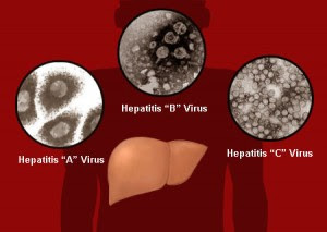 NANDA Hepatitis