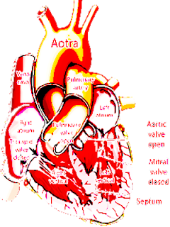 congenital heart disease