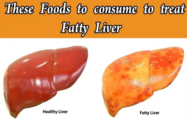 11 Foods to consume to treat Fatty Liver