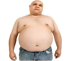 WHAT IS OBESITY/ AND OVERWEIGHT? TYPES OF OBESITY, CAUSES, SYMPTOMS, CHILHOOD OBESITY, DIAGNOSIS, TREATMENT