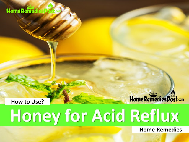 13 Remedies To Cure Acid Reflux With Honey Naturally Fast ...