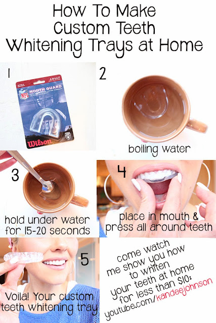 kandeej.com: How To Get Really White Teeth At Home for Cheap