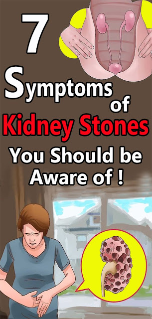 7 Symptoms of Kidney Stones You Should be Aware of 