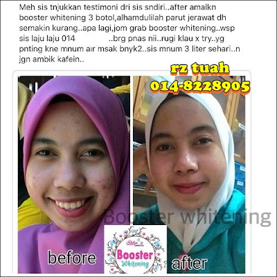 booster whitening shhaz beauty