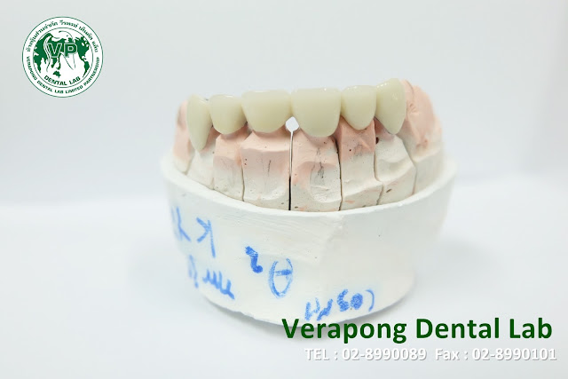 https://www.facebook.com/VerapongDentalLab/