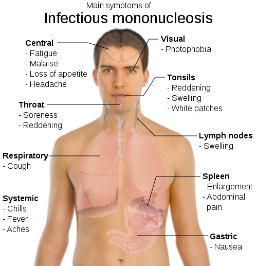 nodes in neck. nodes in neck. nodes in neck.