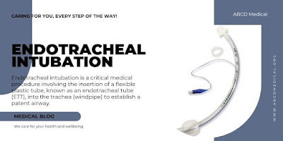 Endotracheal Intubation Explained: Steps, Techniques, and Patient Care