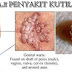 Gambar dan Jenis Obat kutil kelamin di apotik