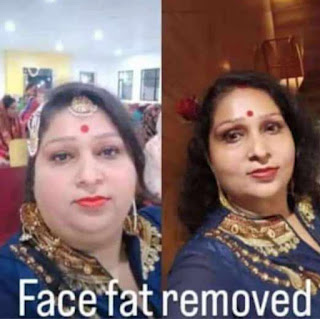 Herbalife Nutrition Face Fat Removed