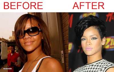 Rihanna Skin Bleaching Before and After