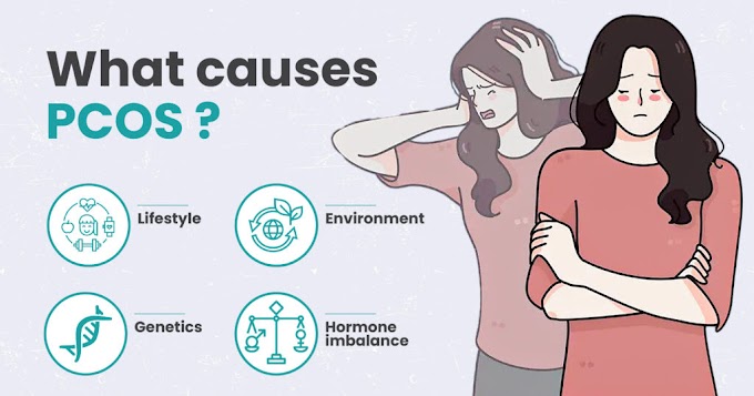 PCOS: The Role of Insulin Resistance and Hormonal Imbalances in Diagnosis and Treatment