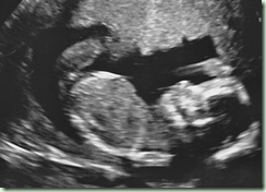 Baby Boy Wood 10-19-11