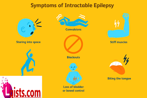 symptoms of epilepsy 