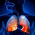 Pneumonia eat more protein will well soon