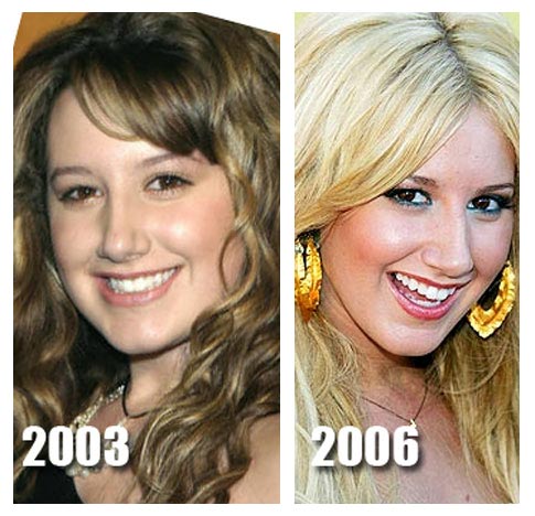 ashley tisdale nose job. Ashley Tisdale Nose Job. On her website Ashley issued the following message: