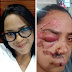 Mulher tem rosto arrastado em asfalto por três assaltantes