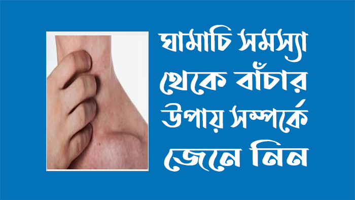ঘামাচি সমস্যা থেকে বাঁচার উপায়