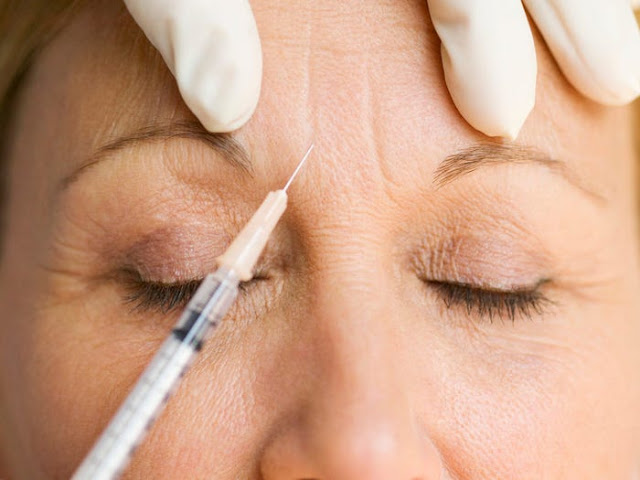 botox treatments The Colony