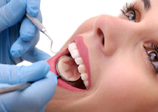 Oral Diseases and Your Health