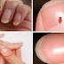 This Is What The Half Moon Shape On Your Nails Mean