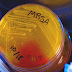 Mengenal Methicilin Resistant Staphylococcus Aureus (MRSA)
