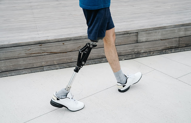 Prosthetic Legs Market