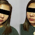 Netizen Suffering From Acne Hits Back At People Who Says Hurtful Stuff At Her