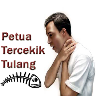 Petua Jika Tercekik Tulang