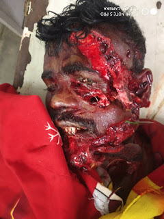 भालू ने फिर बोला युवक पर हमला.........ईलाज के दौरान हुई  मौत.....लगातार हमलो से सहमें लोग