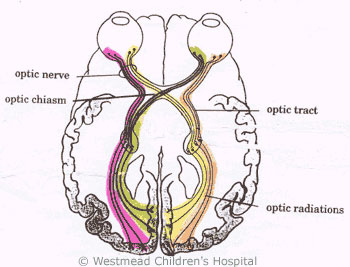 Brain Vision5