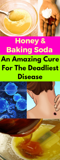 Honey & Baking Soda An Amazing Cure For The Deadliest Disease!!!