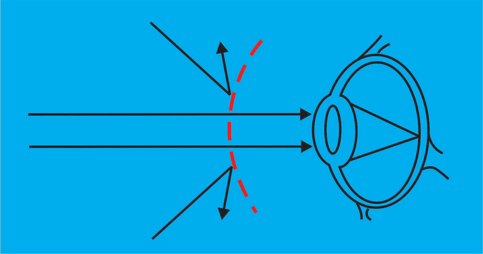 Cara Kerja Kacamata Terapi Pinhole Glasses Vision Agen 