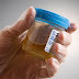 Urine Testing for Cocaine
