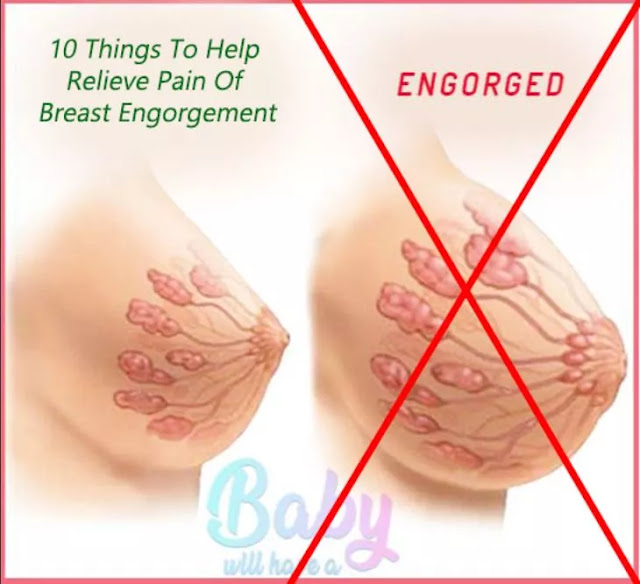 10 Things To Help Relieve Pain Of Breast Engorgement