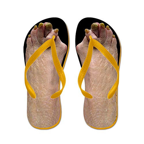 CafePress Ugly Feet Flip Flops, People Will Think You Are Really Really Gross-Out
