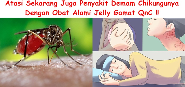 Obat Demam Chikungunya Terampuh Tanpa Efek Samping